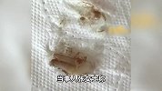 女子点外卖吃出1颗牙齿，商家：我也很纳闷，不清楚牙是怎么来的
