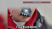 儿童玩密码锁卡住鼻子变“牛魔王”，家长焦急求助消防员