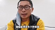 1分钟了解超级毒王：蝙蝠，能携带100种病毒，免疫系统竟与人