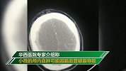 27岁女子整形后没有醒来 专家：颅内血肿可能因脑血管破裂导致