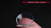 女子长期佩戴美瞳致眼角膜增生，长出小疙瘩，只能手术切除