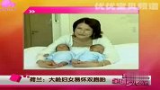 大龄妇女易怀双胞胎