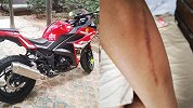 男子练车打不着火被保安拦下 后被误认为小偷遭围观者暴打满身伤