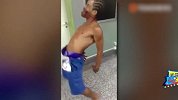 巴西男子脸部中弹后举止怪异疑似“魔鬼附身”，走路像个猩猩！