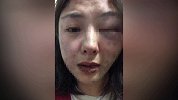 女子西昌旅游在烧烤店遭男子殴打，打人者已被拘留罚款