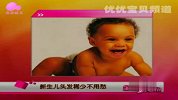 新生儿头发稀少不用愁