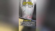 真吞金兽！男童误吞10克金豆6天后排出