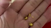 1岁宝宝把金锁嚼碎吞了吓懵妈妈，拍片后无大碍