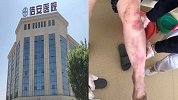 精神病患者医院内死亡身上有淤青 警方介入调查
