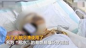 江苏一服装厂4人洗衣服时遭雷击 均被大面积烧伤