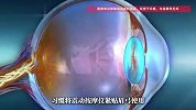 女子每天睡前用眼部按摩仪，1个月后右眼几近失明，医生提醒