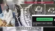 “能活着到医院就是个奇迹”，60岁老人因意外头颈分离，紧急抢救