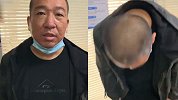 6岁被虐女童已收到捐款156万 父亲鞠躬感谢全国好心人