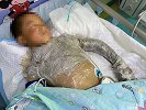男孩摸了下“花蘑菇”整个手变黑差点没命 夏天千万当心它