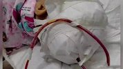 可怕！躺椅从天而降 江西抚州5岁女童被砸中致头骨开裂