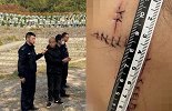 男子求复合不成便怀疑女友出轨 在女方脸上连划三刀