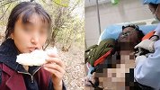 网红遭前夫纵火焚烧重度烧伤 2人离婚复婚后又离婚