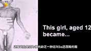 男女共生？一村落患罕见遗传病，居民出生时为女孩到青春期便成为男孩！