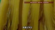 女子吃刚腌制的泡菜，头晕胸闷嘴唇变蓝紫色，医生：腌制初期毒性最强