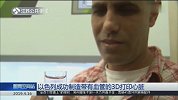 世界首个人体组织3D打印心脏 将来或可移植人体