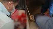 一刚出生男婴被遗弃在公厕垃圾桶 警方介入