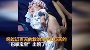胎龄25周女婴奇迹存活出院：出生仅480克身长20厘米