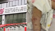无耻！1岁娃被亲妈殴打住进ICU 父亲募捐称孩子有心脏病