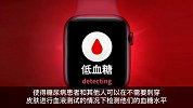 AppleWatch无创血糖监测最晚七年后推出
