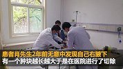 男子腋下长了近6斤重足球大小的肿瘤 医生检查时看傻眼