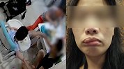 保姆拍打教育幼童遭家属殴打 双双被行拘