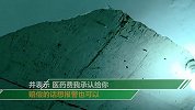 夜半惊魂！男子睡梦中被天花板砸伤：以为在做梦