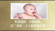 国医话健康-皮肤病（湿疹）怎么预防与治疗