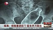 真的猛男！将直径达6厘米的瓶子塞进菊花