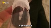 小心水蛭！女孩鼻子不小心吸入水蛭开始不停流鼻血，后在医院取出！