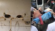 热水器突然爆炸一家三口被烧伤：17个月大幼儿95%烧伤