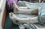 河南一女子称不堪家暴跳楼致双下肢截瘫 商丘市妇联介入