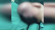 惊险！孕妇在家散步时胎儿突然滑出 头先着地致颅内血肿