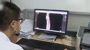 可怕！淮安小伙追求1米8断骨增高 手术失败落下终身残疾