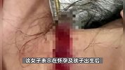 女子称孕期遭家暴被丈夫拿刀割伤喉咙，无锡妇联回应