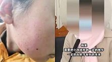 江苏南通：妈妈多次暴力逼迫女儿学习 法院：撤销监护权