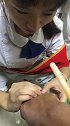 实习护士姑娘给病人打针，看到针扎进去的一刻，我都觉得疼！