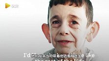 提早失去的童颜！小男孩患早衰症年仅7岁却看起来像70岁的老头！