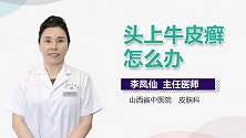 头上牛皮癣怎么办？