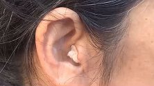 哈尔滨一女子体验免费理疗后耳朵疼 去医院一检查竟是耳膜穿孔