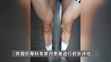 广西百色17岁体育生左膝骨瘤被错切右膝，医院通报：6人被处理