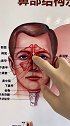 每天跟于大夫学习一点实用知识，鼻窦炎到底咋回事#鼻窦炎 #鼻窦#耳鼻喉于大夫