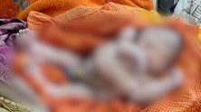 印度女子产下“8肢婴儿” 当地居民涌入医院膜拜