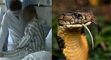 广东一老伯被毒蛇咬伤后步行1小时求医 呼吸心跳骤停险丧命