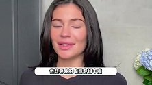 金小妹与以前相比判若两人！大方承认整容：丰唇是我做过最好的事
