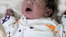 刚出生小宝宝不哭不闹，被医生拍打几下后终于哭了